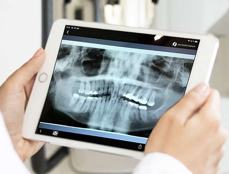 X-ray Teeth